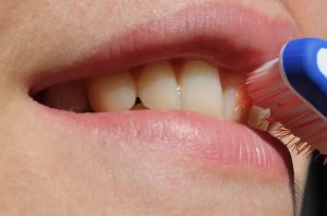 teeth whitening for sensitive teeth
