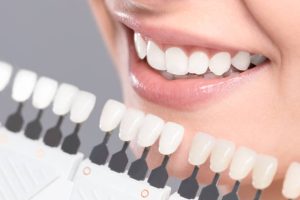 the process of teeth whitening